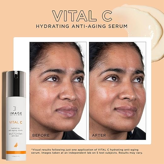 Before and After Results of Using IMAGE Skincare Vital C Serum