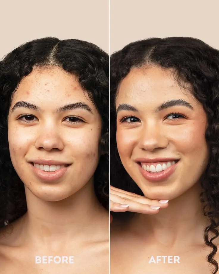 skin  before and after